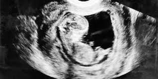 Dari setiap mimpi, banyak orang yang percaya bahwa mimpi yang dialaminya memiliki arti dan berkaitan dengan kehidupan nyata. Cerita Orang Bunian Di Belantara Hutan Sumatera Dan Kalimantan Merdeka Com