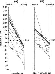 Otherwise risk of thrombus formation is high. The Significance Of Thrombocytopenia In The Development Of Postoperative Intracranial Hematoma In Journal Of Neurosurgery Volume 71 Issue 1 1989