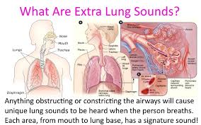 Treating Bronchitis Pneumonia In Preppers Medical Devices