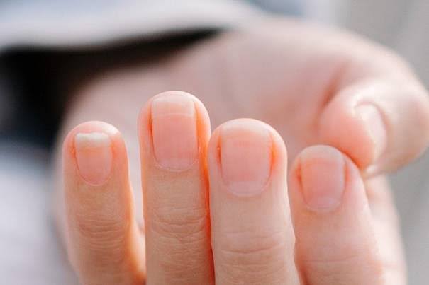 Có thể nhìn móng tay đoán bệnh được không?