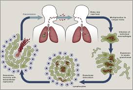 Tuberculosis is an airborne disease, and can be caught by breathing in the air that. Host Evasion And Exploitation Schemes Of Mycobacterium Tuberculosis Cell