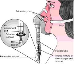 Venturi Mask Definition Of Venturi Mask By Medical Dictionary Medical Knowledge Medical Dictionary Medical Mnemonics