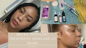 SKINCARE ROUTINE| MICRONEEDLING AT HOME| FIRST OFFICAL YOUTUBE VIDEO EVER!! 