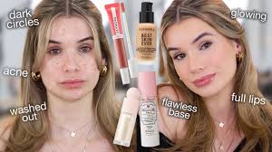 Weitere ideen zu akne hausmittel, akne narben entfernen, zystische akne. How To Instantly Get Rid Of Acne Overnight Actually Works Youtube