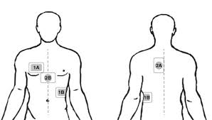 Free vector icons in svg, psd, png, eps and icon font. Approximate Placement Of Defibrillation Pads For Dsed Dsed Double Download Scientific Diagram