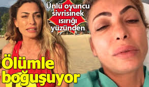 Unlu Oyuncu Sivrisinek Isirigi Yuzunden Olumle Bogusuyor Leyla Bilginel Kimdir Hangi Hastaliga Yakalandi A24