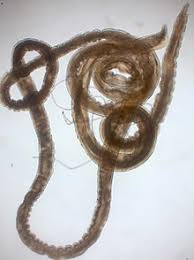 We did not find results for: Gongylonema Pulchrum Wikipedia