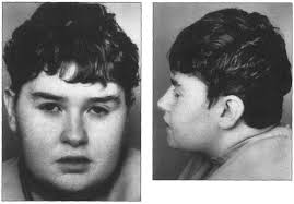 Figure 2 from Cohen syndrome with neutropenia-induced periodontitis managed  with granulocyte colony-stimulating factor (G-CSF): case reports.