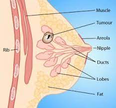 Early warning signs of breast cancer common symptoms of breast cancer include: Breast Cancer Health Wellbeing