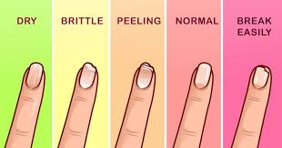 If you lose a toenail, it might take a year and a half to grow back! Pin By Judy Monteverde On Good To Know Grow Nails Faster How To Grow Nails Long Fingernails