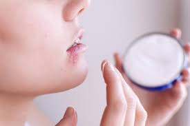 Realize that this neuron will not grow and divide, as yes, as soon as i feel the tingle on my mouth, i take 4 valtrex, then 4 more 12 hours later. Herpes Simplex Symptoms Pictures Types Treatment