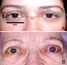 Clinical Evaluation of the Orbit
