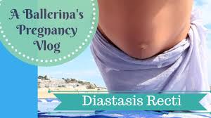 During pregnancy, your growing uterus puts pressure on the two bands of diastasis recti generally isn't dangerous, but in rare cases, a hernia can develop if your organs poke through how can i prevent it? Coning And Doming Preventing Diastasis Recti In Pregnancy With Demos And Ice Cream Youtube