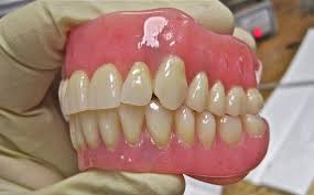 Do not force the denture upon placement or removal. Dentures How To Make The Most Out Of Them Malmin