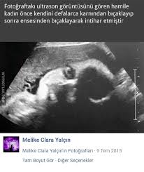 Hurriyet Aygun Adli Kullanicinin Etkileyici Panosundaki Pin Goruntuler Ile Gercekler