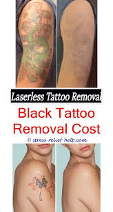 How much does it hurt to get a tattoo? How Long Does Laser Tattoo Removal Take How Much To Remove A Small Tattoo Can You Remove A Tattoo Rig Tattoo Removal Cost Tattoo Removal Eyebrow Tattoo Removal
