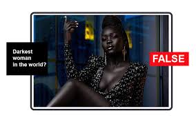 This is commonest among people living in a dry savannah environment where the sun burns throughout the day. No Model Nyakim Doesn T Hold Record For Darkest Girl In World The Standard