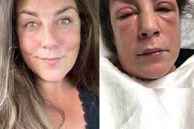 Fundraiser by Jamie Royer : Jamie's Big Fight!!!