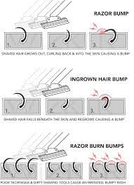 Ready to learn how to shave your pubic hair the right way? Why Do Black Men Get Razor Bumps Quora