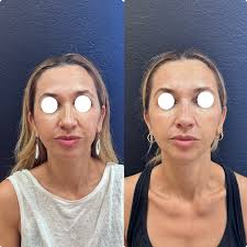 Dra Justina Lopez /medicina (@drajustinalopez) • Instagram photos and videos