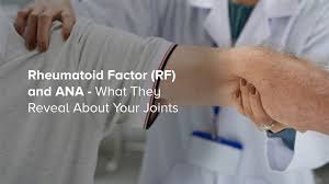 Image result for Rheumatoid Factor