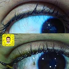 بصمة قزحية العين التي هي في الوقت الحاضر تعد من أفضل الطرق الأمنية للتأكد من هوية الأشخاص حيث إنها تعتبر الأسهل تطبيقاً على. Ø¯ Ø³Ø¹ÙˆØ¯ Ø§Ù„Ø³Ù„Ø·Ø§Ù† On Twitter Ø£Ø­Ø¯ Ø§Ù„Ù…Ø±Ø¶Ù‰ Ø¨Ø§Ù„Ø¹ÙŠØ§Ø¯Ù‡ Ø¨Ø¹Ø¯ Ø¥Ø³Ø¨ÙˆØ¹ Ù…Ù† Ø¥Ø²Ø§Ù„Ø© ÙˆØ­Ù…Ù‡ Ø¹Ù„Ù‰ Ù…Ù„ØªØ­Ù…Ø© Ø§Ù„Ø¹ÙŠÙ† Https T Co K6bwxk30iw Twitter