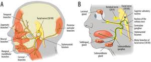 Cranial Nerve Abnormalities Wikem