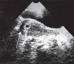 For palmer, who recently announced her own pregnancy and often discusses motherhood on her website your zen mama, the storytelling change is just something that required acceptance on her. Jaypeedigital Ebook Reader