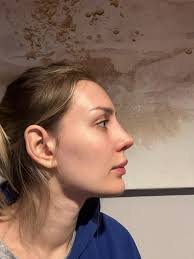 Okay time for my experience so far ( 3/4 weeks post op) so quite fresh! But  I wanted to tell give my thoughts