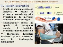 If you're having trouble managing your tennis elbow, please seek a consultation with a physical therapist or other healthcare professional. Tennis Elbow Physical Therapy Ppt Download