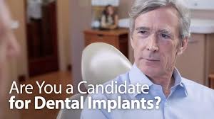 Are You a Candidate for Dental Implants