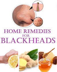 Home Remedies For Blackheads Home Remedies Remedies Natural Body Care