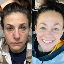 I'm not saying collagen matters but collagen matters. 😘 The type of  collagen you use…matters (example: