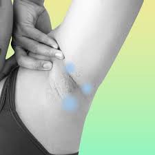 If you're very sweaty around your vagina, you might wonder how to handle all that perspiration. How To Tell If Your Excessive Sweating Is Actually Hyperhidrosis Allure