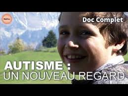 Quentin jeune jurassien aimerait avoir enfin deux oreilles