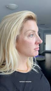 MICHELLE BORQUEZ, RN