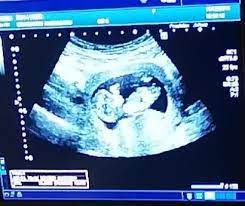 149 Hasta 154 Latidos Club Junio 2019 Embarazo Y Bebes Babycenter