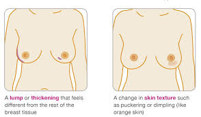 Pain, surprising as it may sound, is not a typical sign of breast cancer.10 breast pain could be the result. What Are The Symptoms Of Breast Cancer