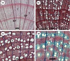Check spelling or type a new query. Light Microscopy Images Of Transverse Sections Of Conifer And Download Scientific Diagram