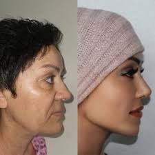 Operaciones Estambul