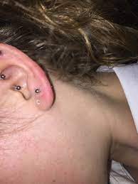 Feb 21, 2018 · if your ear piercing is tender or painful to the touch it may be a sign of infection. Is My Lobe Piercing Infected Quora