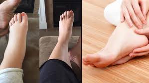 Kaki bengkak tentu membuat tidak nyaman orang yang mengalaminya. Kaki Bengkak Saat Hamil Memang Wajar Tapi Bisa Diatasi Dengan 15 Trik Pintar