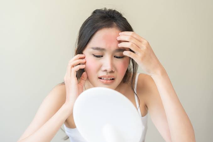 Skinformation: Dry sensitive skin - Skin Spectrum