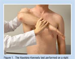 Image result for Hawkins Test