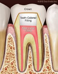 If you are receiving treatment over two appointments, the first appointment as a general estimate, any single root canal appointment will last somewhere between 30 and 60 minutes, but in more complicated cases, the dentist may need as long as an hour and a half. Root Canal Treatment How Long Will It Last