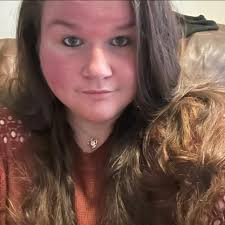 I'm so proud of my weight loss and acne healing ❤️‍🩹￼