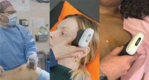 [VIDEO SERIES] Master Advanced Ultrasound Techniques for Plastic Surgery