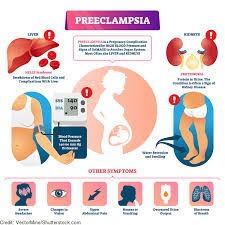 The oxford dictionary defines interv. Preeclampsia Eclampsia Nursing Maternity Review