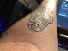 Feb 28, 2020 · tattoo dyes — especially red, green, yellow and blue dyes — can cause allergic skin reactions, such as an itchy rash at the tattoo site. My Year And A Half Old Tattoo Is Itchy And Raised Over The Last Month Any Idea What Could Have Caused This Relatively Out Of The Blue Lotion Keeps It From Itching