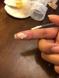 How to fix clogged milk duct. I Think I Have A Clogged Duct Breastfeeding Forums What To Expect